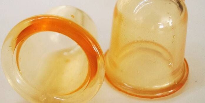 prostatitis treatment cups