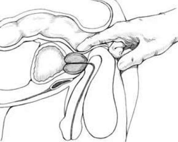 prostate massage for prostatitis